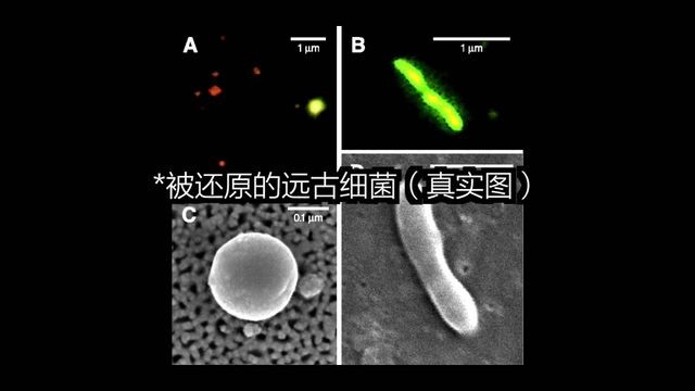 被还原的远古病菌真实图