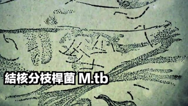 结核分支杆菌M.tb