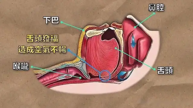 舌头长肉