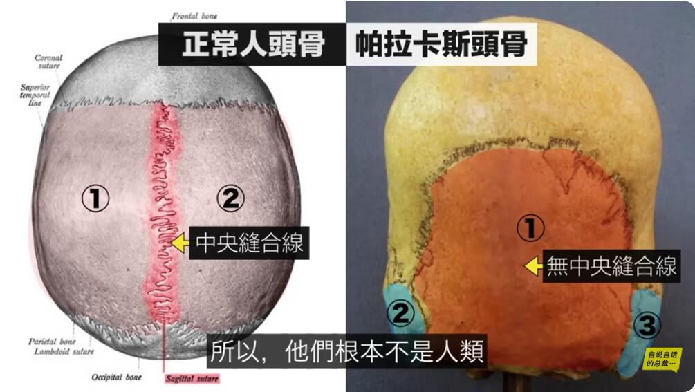 两种头骨对比